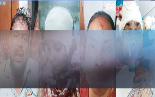 রাজশাহীতে জমি সংক্রান্ত বিরোধের জেরে প্রতিপক্ষের হামলায় একই পরিবারের ৫ সদস্য আহত, পিতা-পুত্র গ্রেফতার